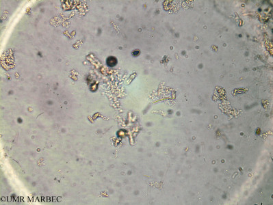 phyto/Brazilian_Amazon_coast/Amazomix_station_11/AMAZOMIX September 2021/Prorocentrum cf rhathymum (Am_ST11_r4_surf_cf_prorocentrum240821_002)(copy)_thumb.jpg